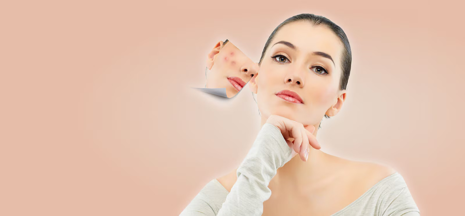 Skin Care Treatment Moosapet